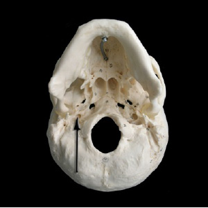 Figure 1. Jugular Foreman